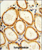 Rabbit Polyclonal Antibody to CASP2