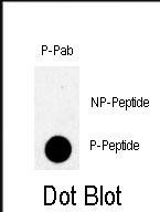Phospho-TBK(S172)