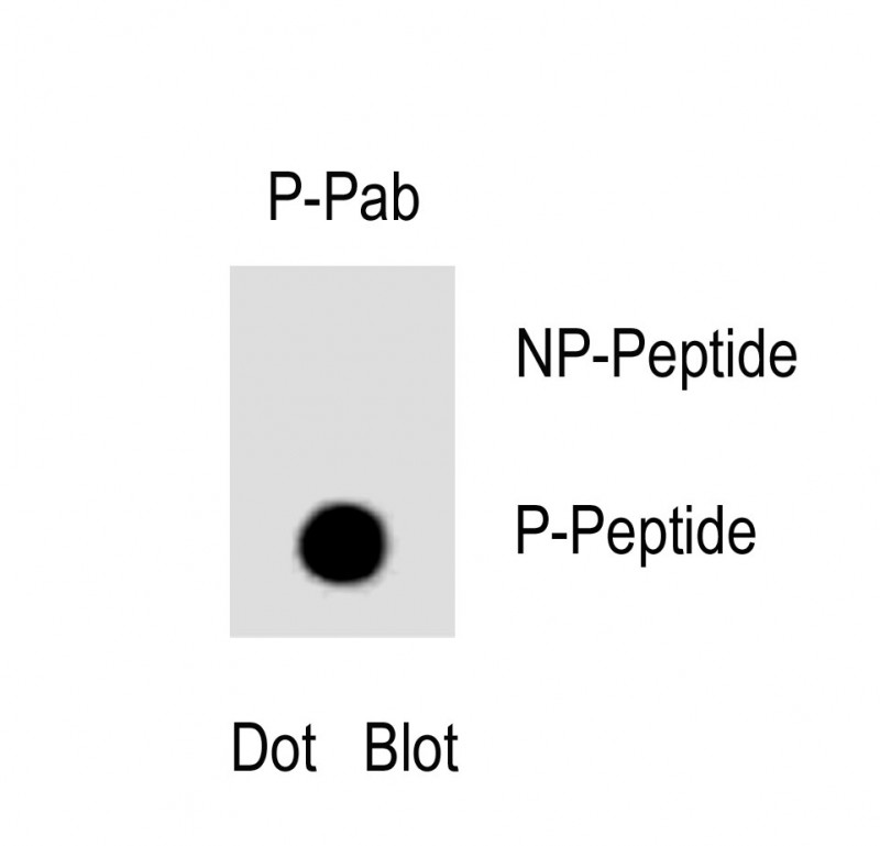 Rabbit Polyclonal Antibody to Phospho-TBK(S172)