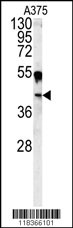 CA14 (N-term)