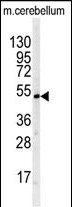 Rabbit Polyclonal Antibody to BTBD1