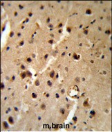 Rabbit Polyclonal Antibody to PTHLH