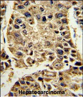 Rabbit Polyclonal Antibody to SERPINA4