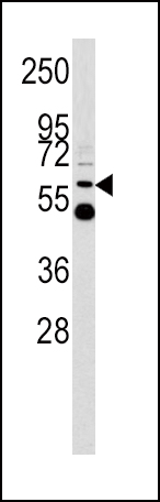 UDB17