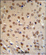 Rabbit Polyclonal Antibody to WTX