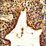 Rabbit Polyclonal Antibody to VIP