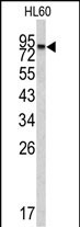 CPXM2 (N-term)