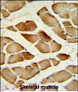 Rabbit Polyclonal Antibody to CTSF (Center D276)