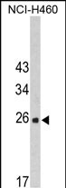 FKBP14 (N-term)