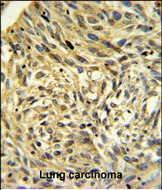 Rabbit Polyclonal Antibody to FKBP14 (N-term)