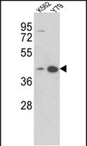 AZGP1 (N-term)