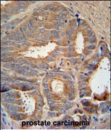 Rabbit Polyclonal Antibody to AZGP1 (N-term)