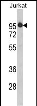 HTATSF1 (N-term)