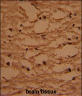 Rabbit Polyclonal Antibody to HTATSF1 (N-term)