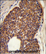 Rabbit Polyclonal Antibody to MTBP
