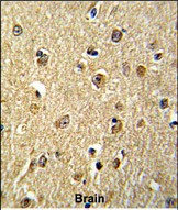 Rabbit Polyclonal Antibody to NKRF