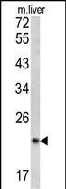 SPCS3