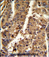 Rabbit Polyclonal Antibody to PSME2