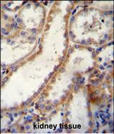 Rabbit Polyclonal Antibody to FKBP10