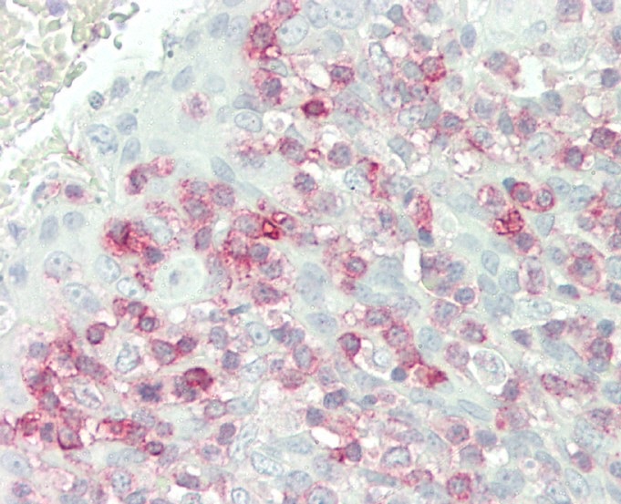 Rabbit Polyclonal Antibody to FKBP10