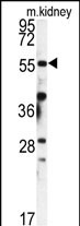FKBP9 (N-term)