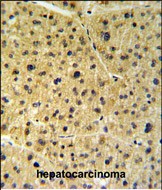 Rabbit Polyclonal Antibody to FKBP9 (N-term)