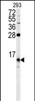 FKBP1B (N-term)