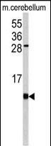 Rabbit Polyclonal Antibody to FKBP1B (N-term)