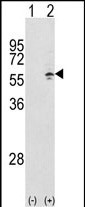 Rabbit Polyclonal Antibody to CCT3