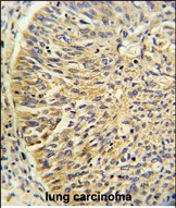 Rabbit Polyclonal Antibody to CCT3