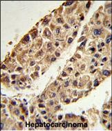 Rabbit Polyclonal Antibody to ITIH2