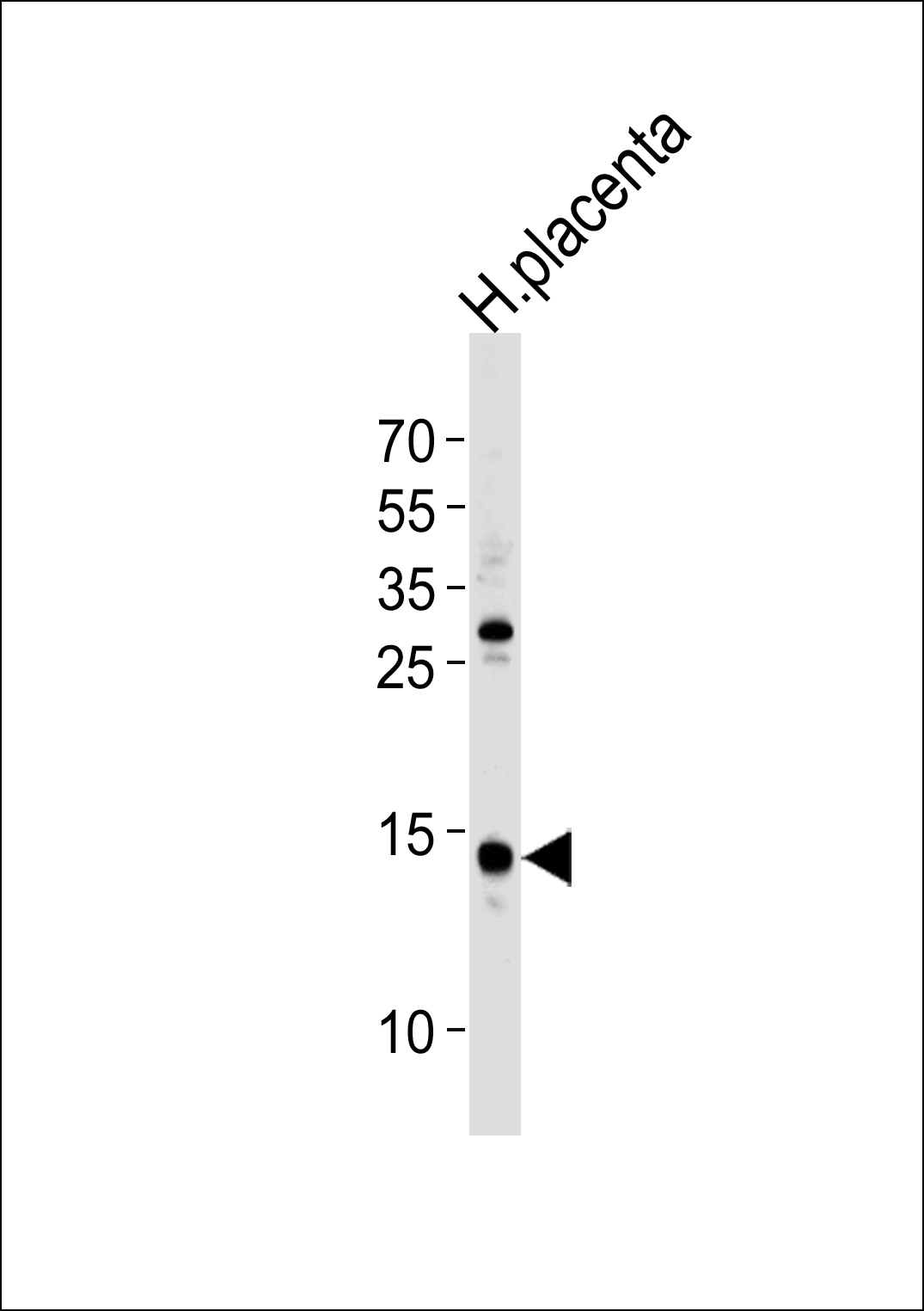 FKBP2 (N-term)