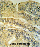 Rabbit Polyclonal Antibody to FKBP2 (N-term)