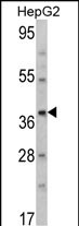AMT (N-term)