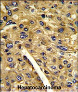 Rabbit Polyclonal Antibody to AMT (N-term)