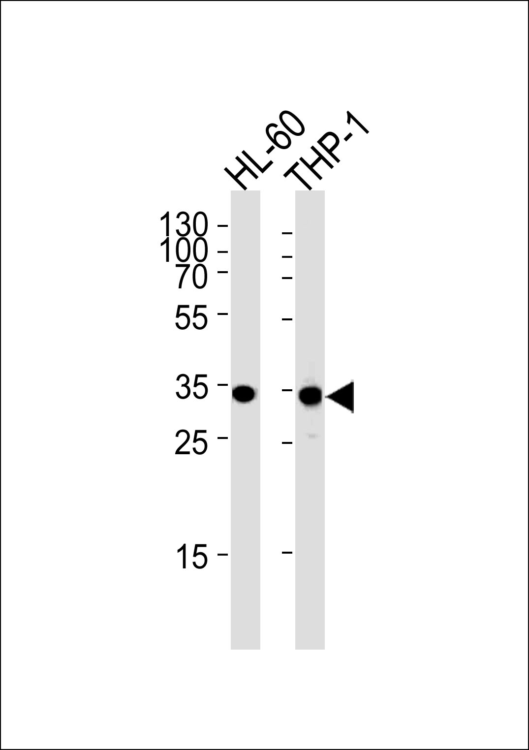 MDH1