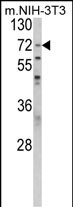 PABPC1