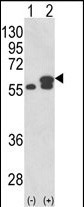 Rabbit Polyclonal Antibody to PDIA3