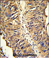 Rabbit Polyclonal Antibody to PDIA3