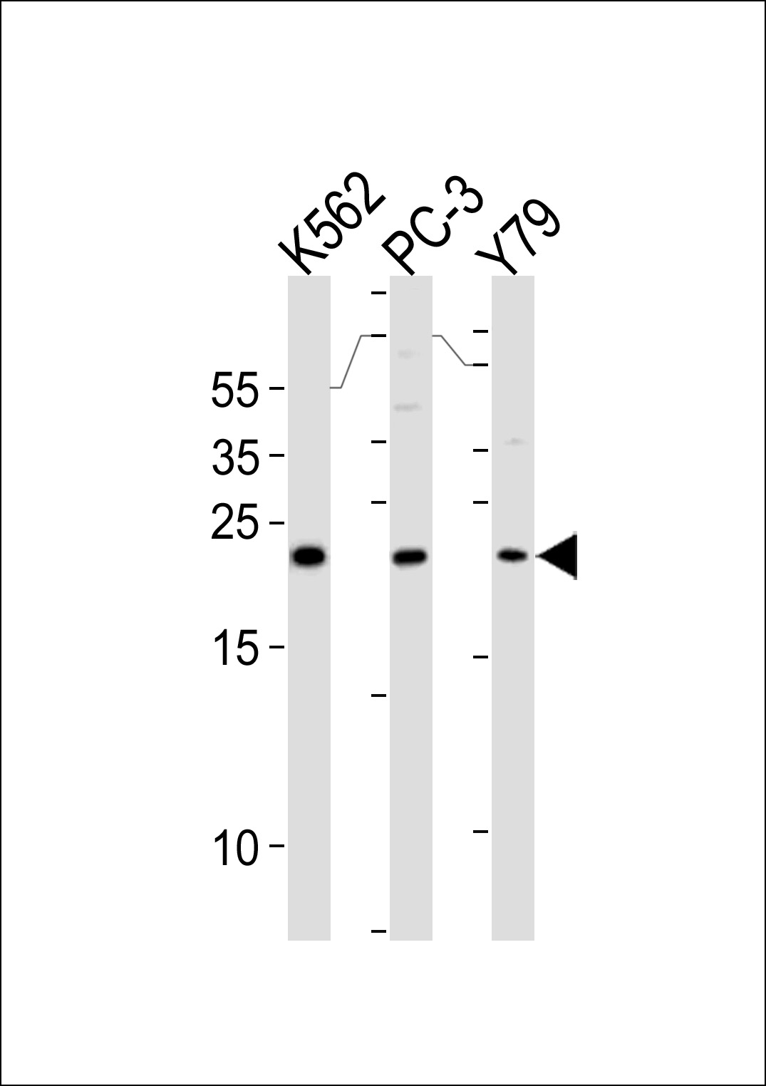 GSTP1