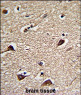 Rabbit Polyclonal Antibody to PGLS