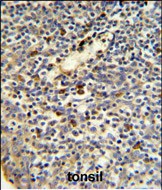 Rabbit Polyclonal Antibody to FKBP11 (N-term)