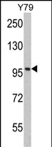 KPNB1 (N-term)
