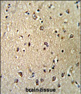 Rabbit Polyclonal Antibody to KPNB1 (N-term)