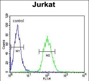 Rabbit Polyclonal Antibody to ALAD