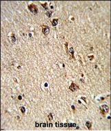 Rabbit Polyclonal Antibody to ALAD