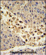 Rabbit Polyclonal Antibody to COLEC11 (N-term)
