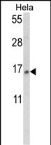SNRPD2 (N-term)