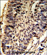 Rabbit Polyclonal Antibody to SNRPD2 (N-term)