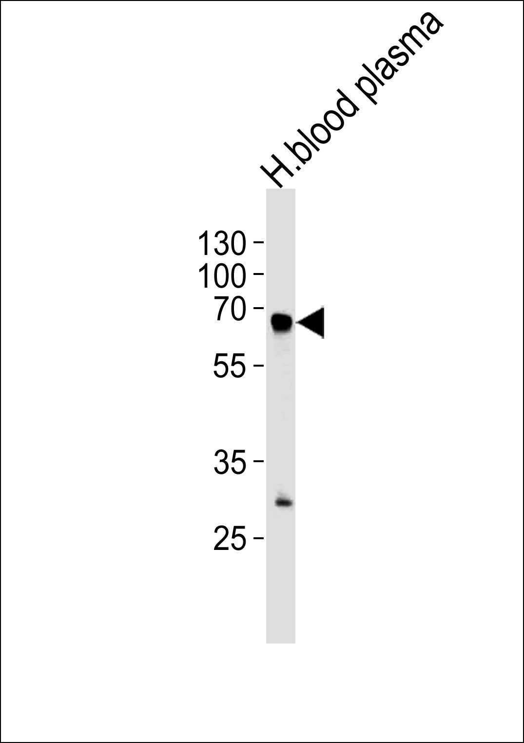 FGA (N-term)